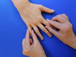 Behandlung der Finger mit dem Osflow zur Linderung von Arthrose.